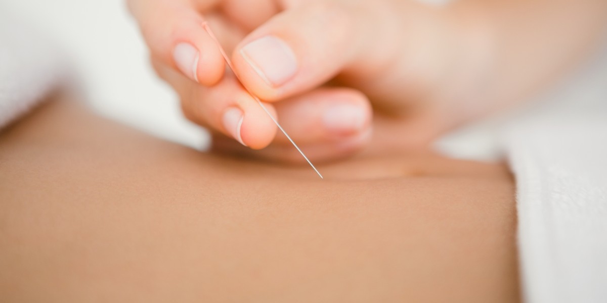 Can Acupuncture Be Effective For Back Pain