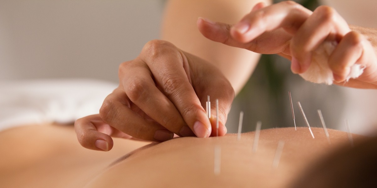 Can Acupuncture Help Treat Back Pain?